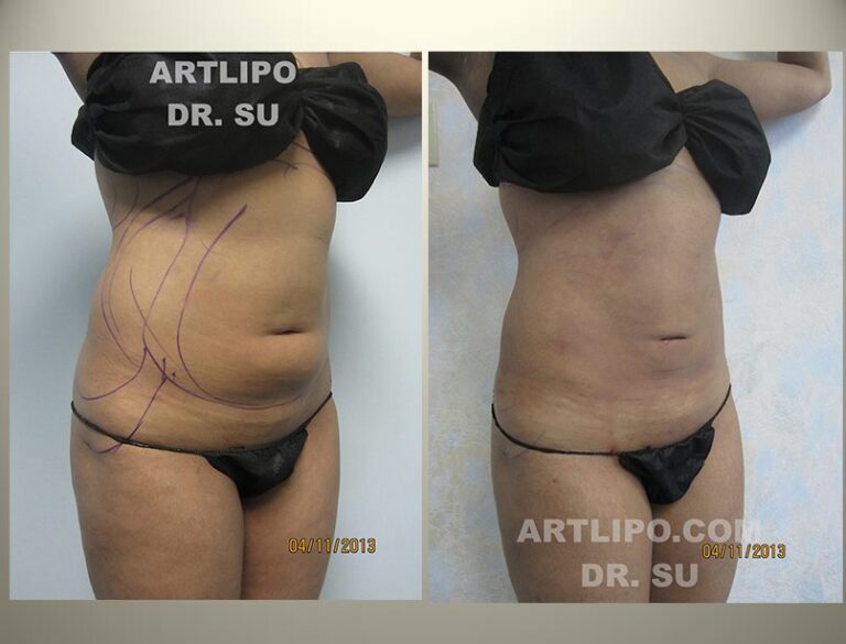 patient photo