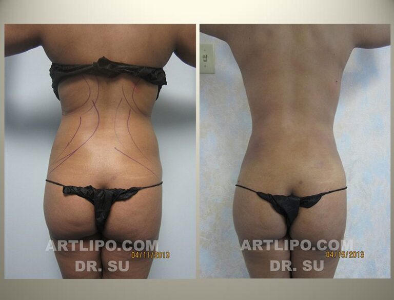patient photo