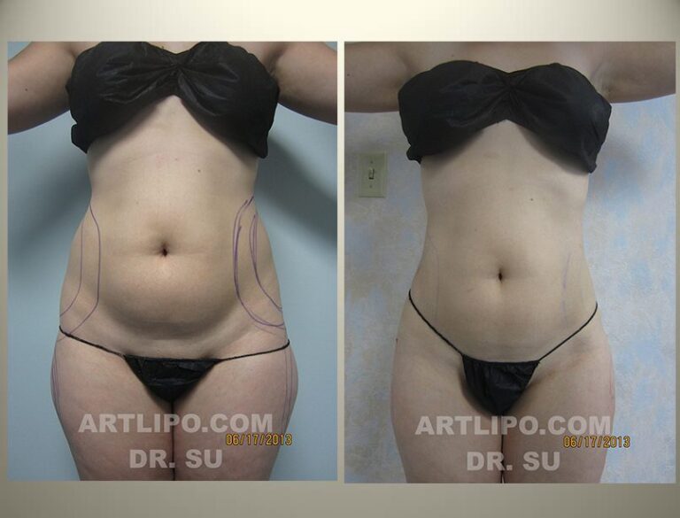 patient photo