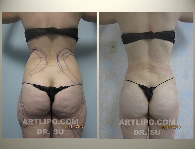 patient photo